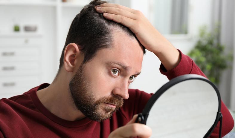 apakah-hair-transplant-bertahan