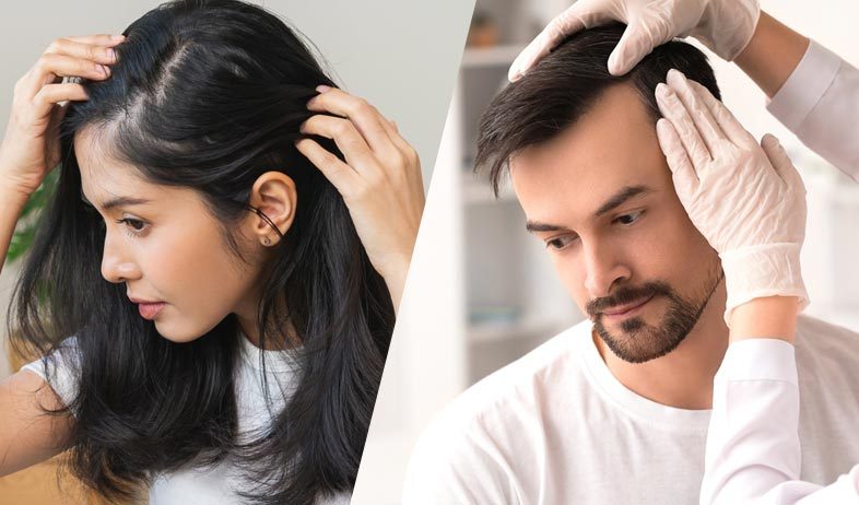 perbedaan-hair-transplat-pria-wanita